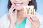 Dental Implant Options Explained: Complete Guide, Costs, Benefits & Expert Tips